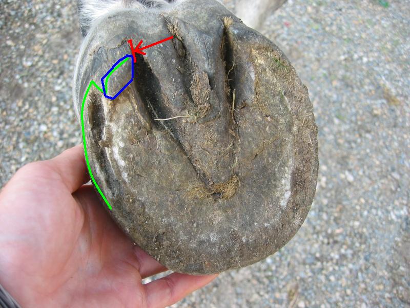 Pathologies du pied: décollement de la paroi 334_0910